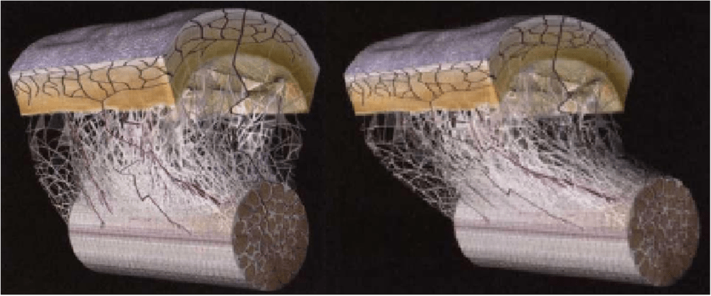 Inside fascia with with change of outer layers