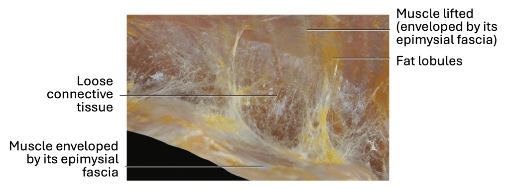 Loose Connective Tissue